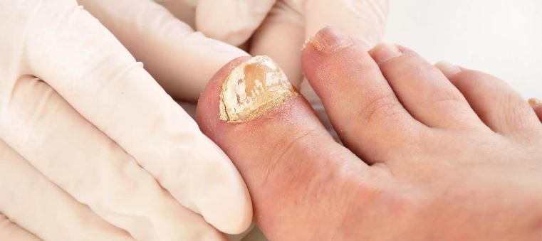 image: Paraffin Wax Footbath used for foot pain and dry cracked heels